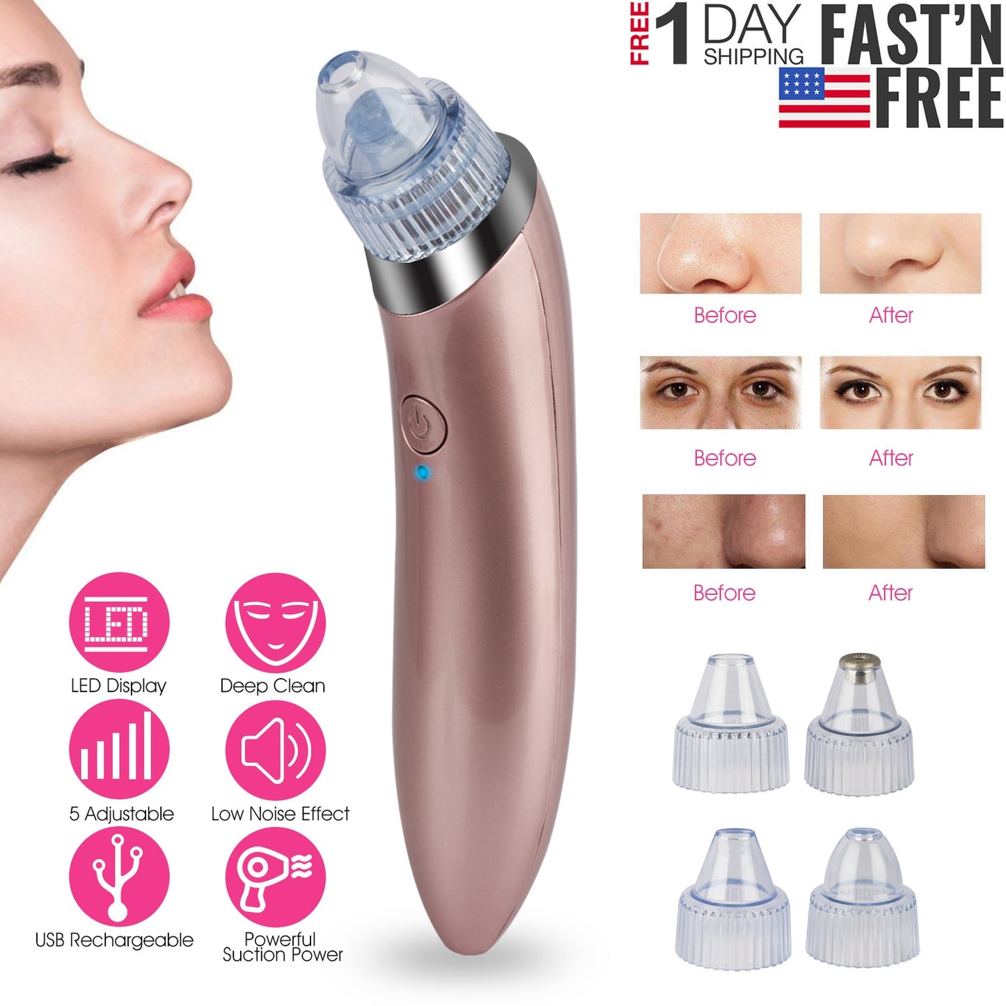 Electric Blackhead Remover Vacuum Suction Facial Pore Cleaner Acne Pimple Extra